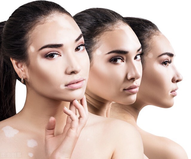 村里人说这个痣非“凶”即“淫”,吓得妈妈赶紧带孩子去点痣