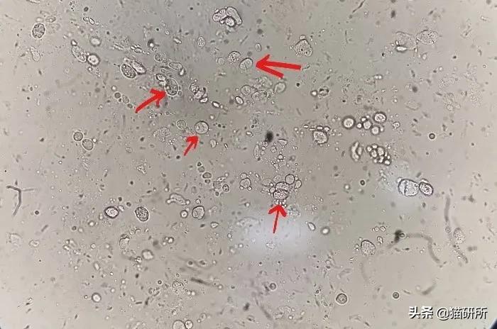 显微镜下的猫屎，竟然和这么多食物都撞脸？