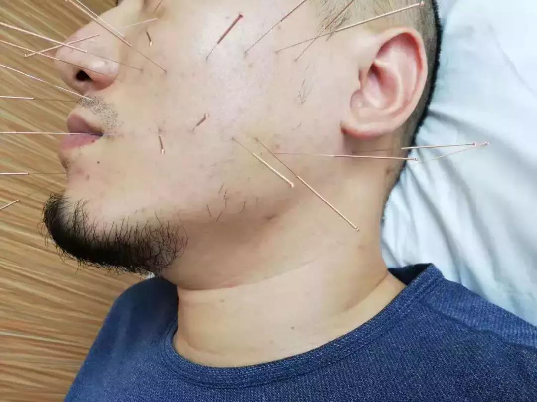 学得济世术回报家乡人——附属医院康复医学科董月秋