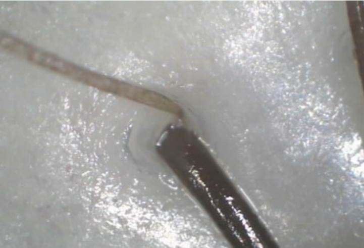 清洗头皮毛囊会长头发么,头皮毛囊清理洗头方法