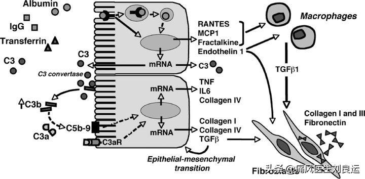痛风引起的肌酐高怎么治疗,痛风肌酐高需要看肾内科吗