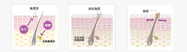 混合性皮肤怎么去角质,怎样去角质护肤