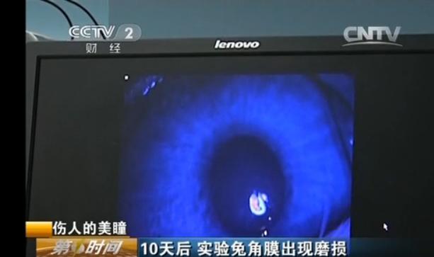 青少年女生戴美瞳会影响眼睛视力 (女生戴美瞳的后果导致眼睛失明)