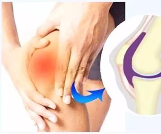 髋关节滑膜炎日常注意事项,宝宝髋关节滑膜炎要注意什么