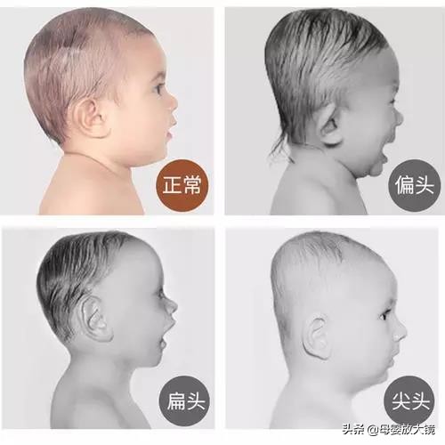 新生儿的100个常见异常,天使宝宝婴儿期表现