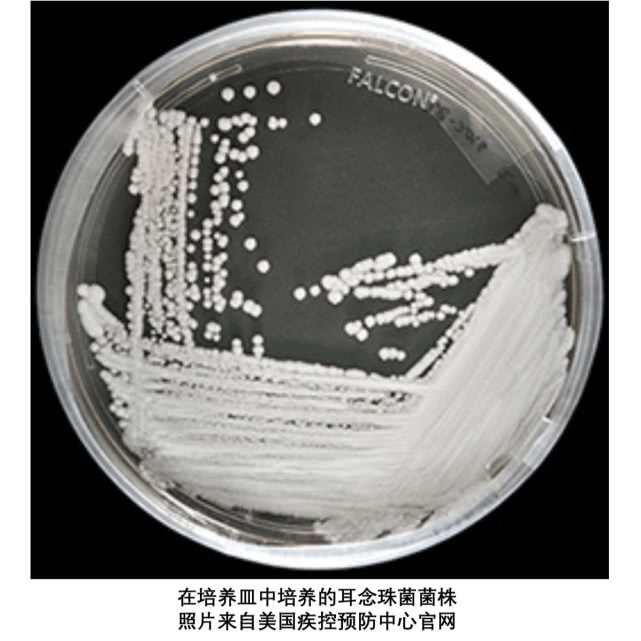 闻臭袜子真会导致真菌感染吗,闻臭袜子会真菌感染导致发烧吗