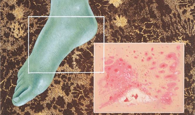 彻底解决脚臭的小妙招,夏天脚臭太尴尬教你一招