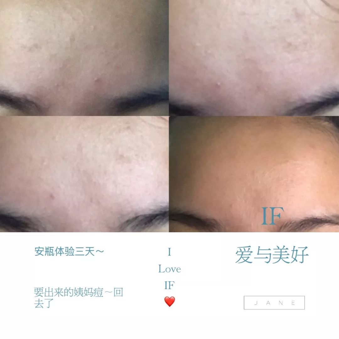 家用美容仪能用自己的精华么,用完美容仪能用精华吗