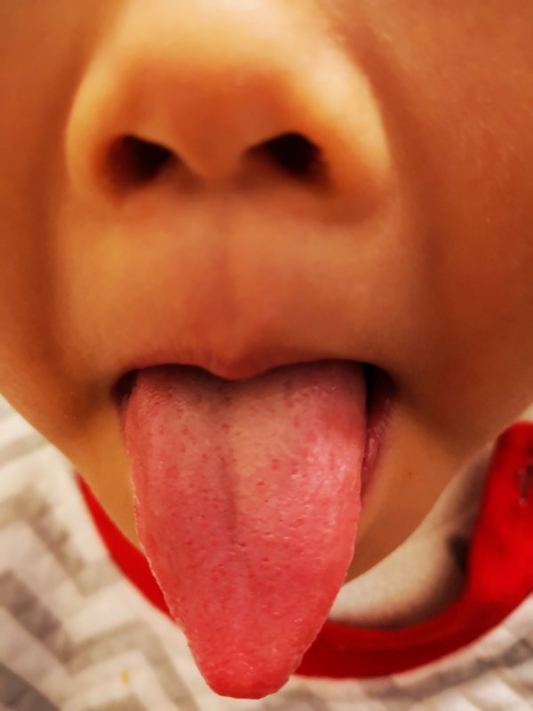 紧急通知:今冬流感的病因找到了,最简单的中医预防方法在此!