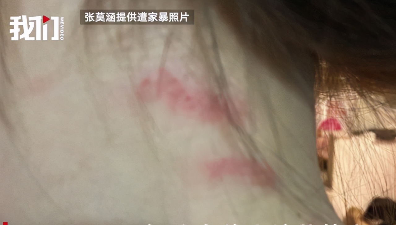 美女主播爆运动员丈夫孕期家暴还被拔指甲，男方甩锅激素太无语