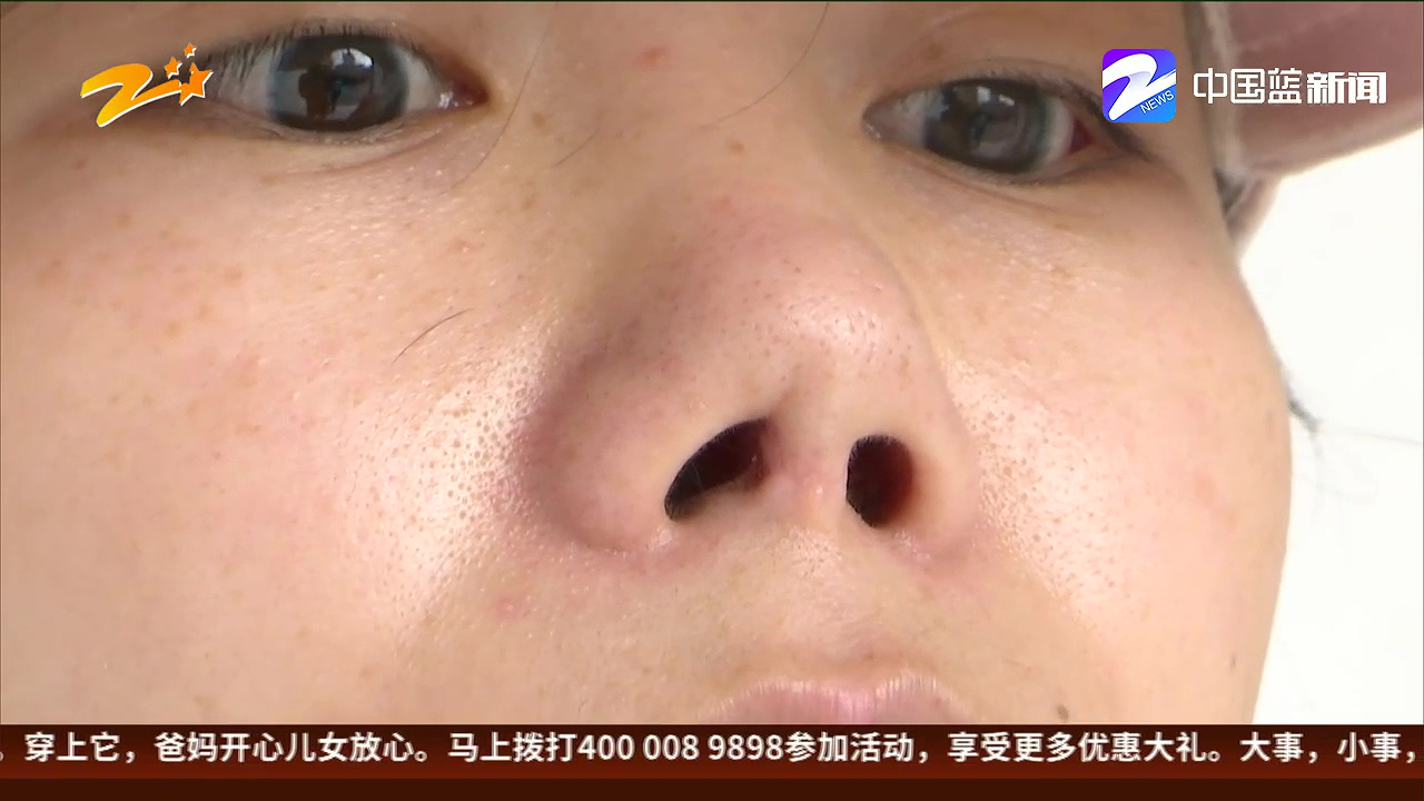 女子隆鼻手术出血,女性做鼻综合手术后的心态