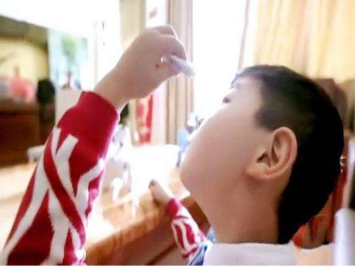 宝宝误吞食502胶水,误食101胶水