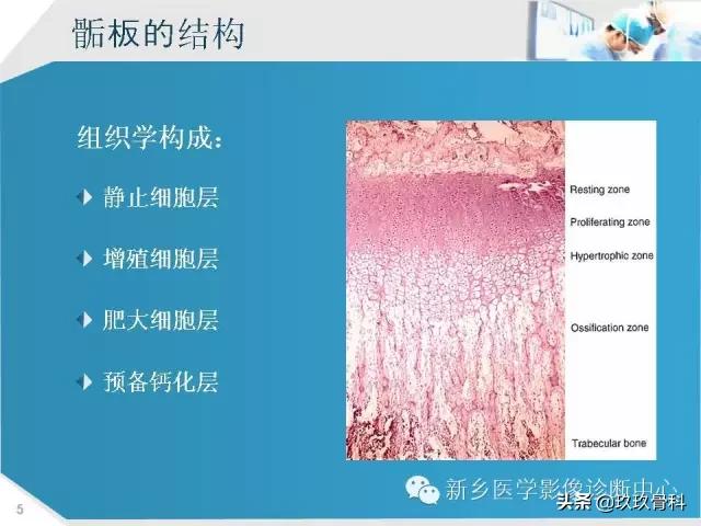 骨骺损伤x线表现,骨骺损伤磁共振表现