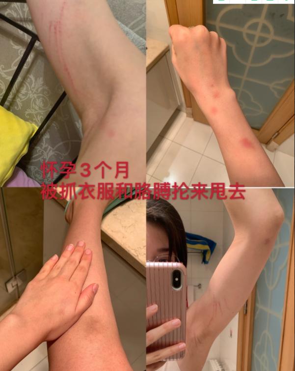 张培萌100米跑赢苏炳添,张培萌飞人事件