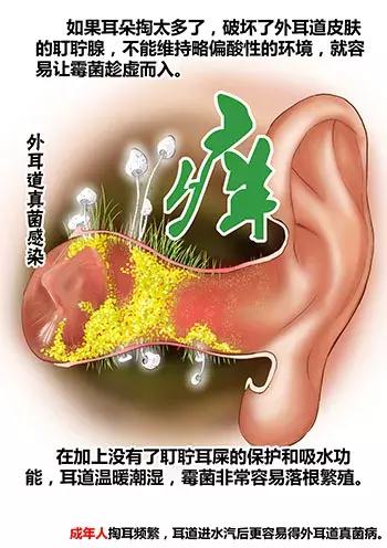 游泳耳朵进水了一直嗡嗡响怎么弄,游泳时耳朵进水了有点疼怎么处理