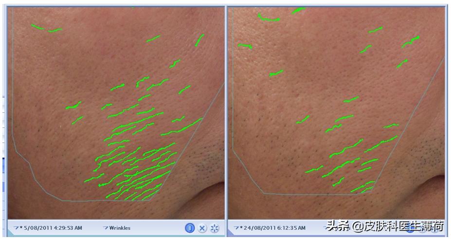 医美皮肤科医生怎么学,皮肤科医生介绍医美项目