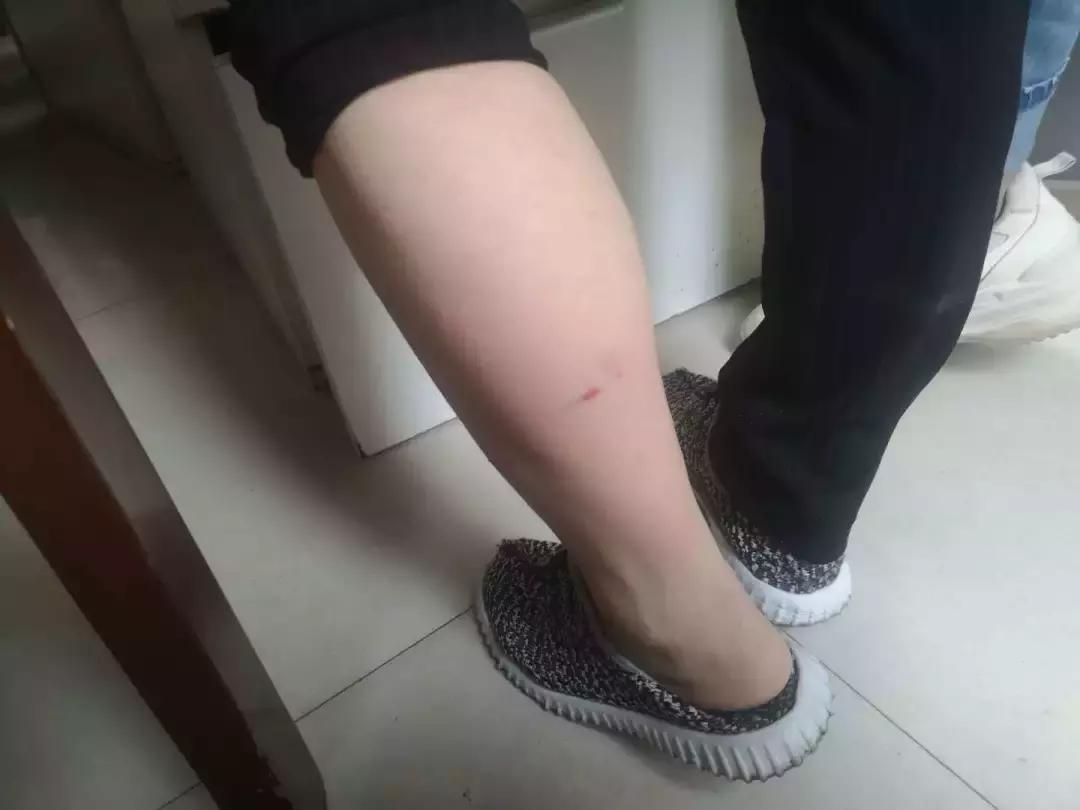 瑞安全城通缉一条白色肇事犬！已咬伤多人，目前已抓获2条疑似犬，将继续加强全城搜寻