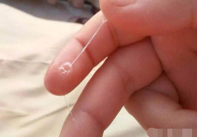 女性排卵时有什么感觉吗,彩超检测排卵怎么知道卵子已排出