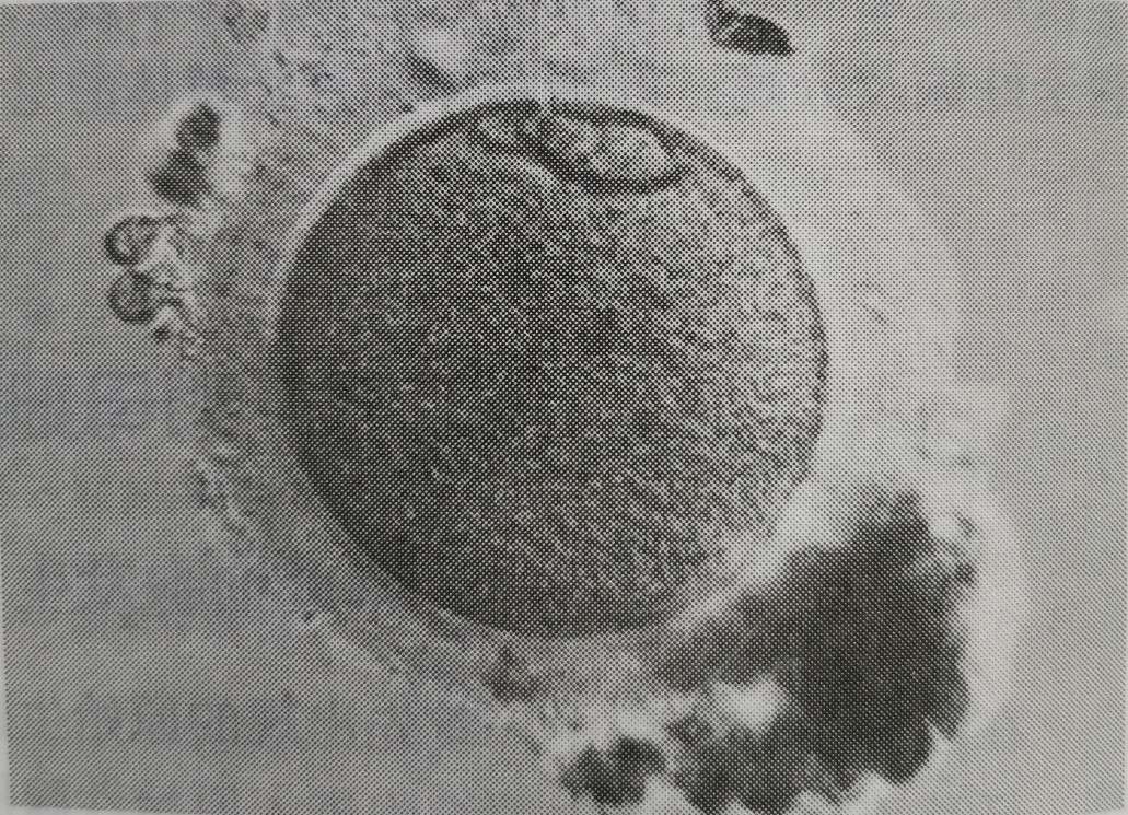 卵泡标准图片大全,微观卵泡是什么样子