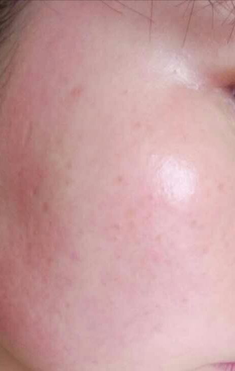 敏感肌适合的洗面奶乳液,适合红血丝皮肤的乳液