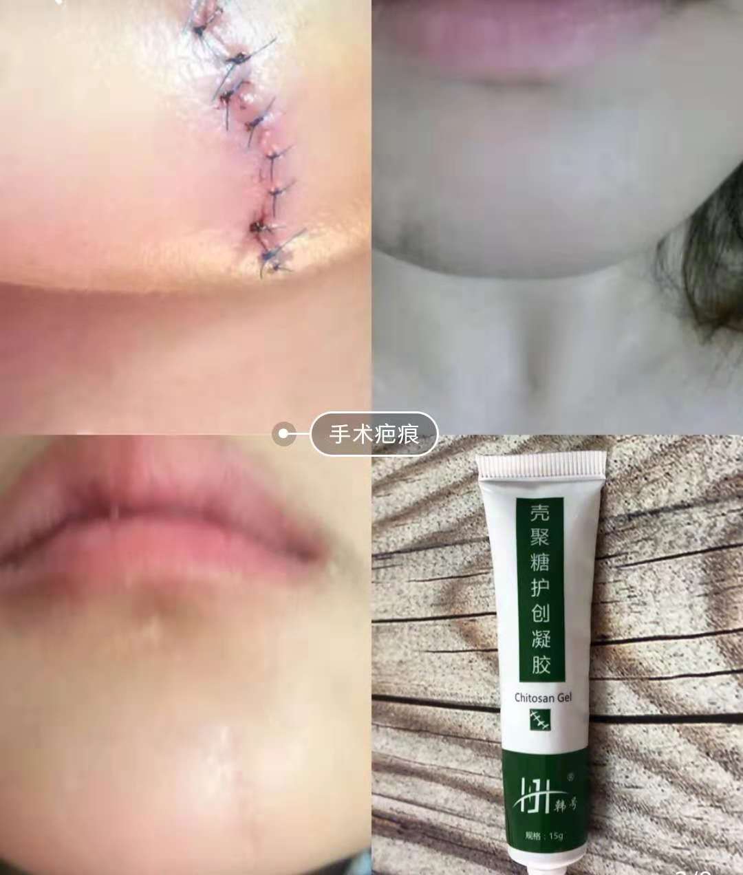 去妊娠纹修复测评推荐,去妊娠纹测评红黑榜