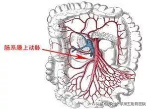 房颤患者的噩梦之不一样的急性腹痛——肠系膜上动脉栓塞