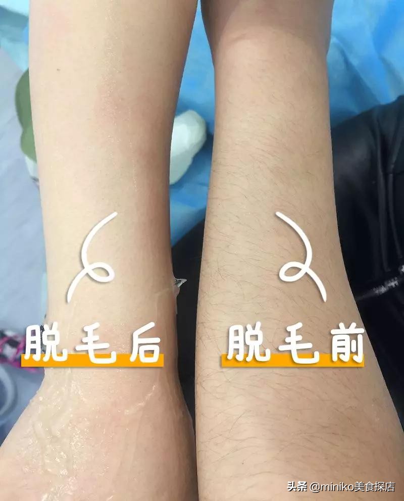 祛痘、脱毛、洗牙？点开这篇文章，离女神更近一步