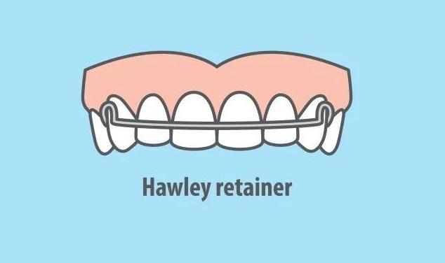 所有矫正都要戴保持器吗,成年人矫正牙齿需要戴保持器多久