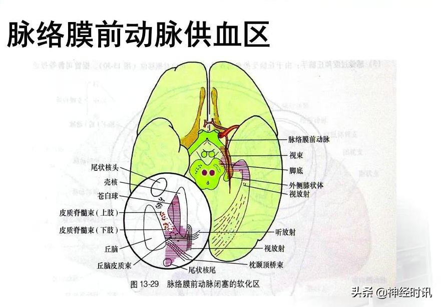 脑动脉解剖学讲解,脑膜中动脉解剖讲解