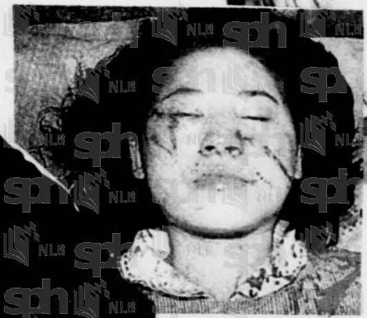 被前两任丈夫毁容家暴,惨遭丈夫家暴32年痛不欲生