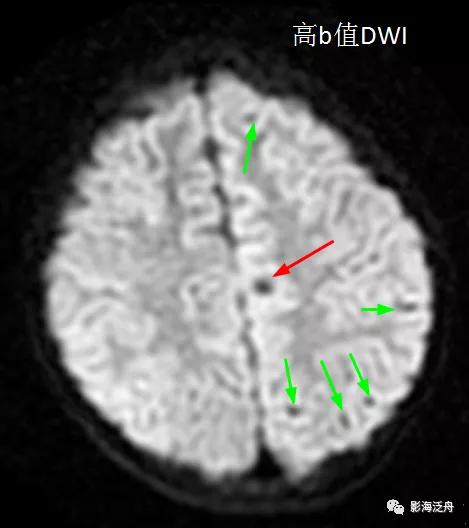 棰呰剳纾佸叡鎸痙wi搴忓垪,棰呰剳dwi搴忓垪鏈鏄庢樉寮傚父