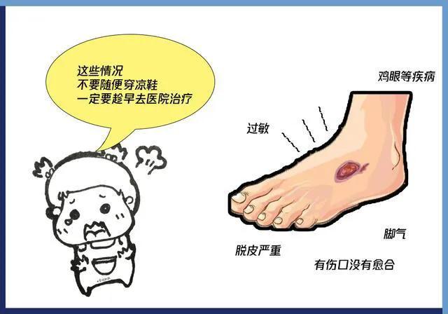 夏天总穿凉鞋皮肤粗糙,脚粗糙夏季如何穿凉鞋