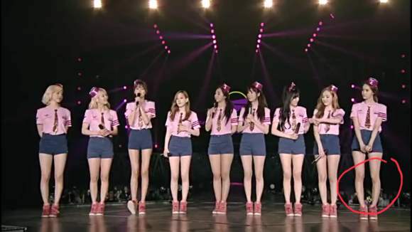 如何拯救o型腿,矫正o型腿的简单小技巧