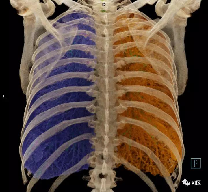 如此详细的肺部影像解剖，有点儿酷