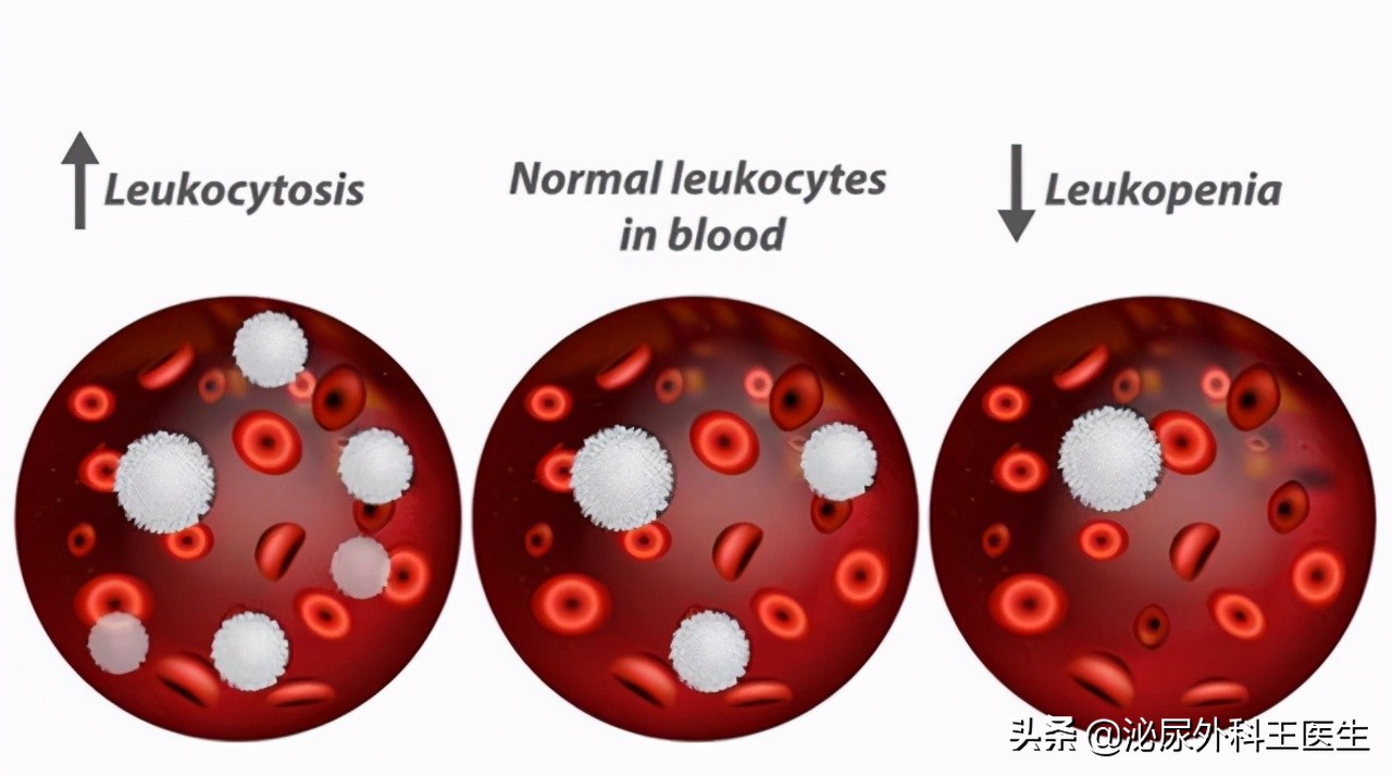 治疗ed需要天天服用西地那非吗,西地那非治疗ed一般吃多久能治愈