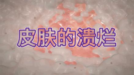 世界糖尿病日的相关文章,世界糖尿病日活动方案选品