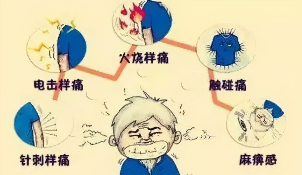 带状疱疹错过最佳治疗时期,带状疱疹是个大隐患早认识早治疗