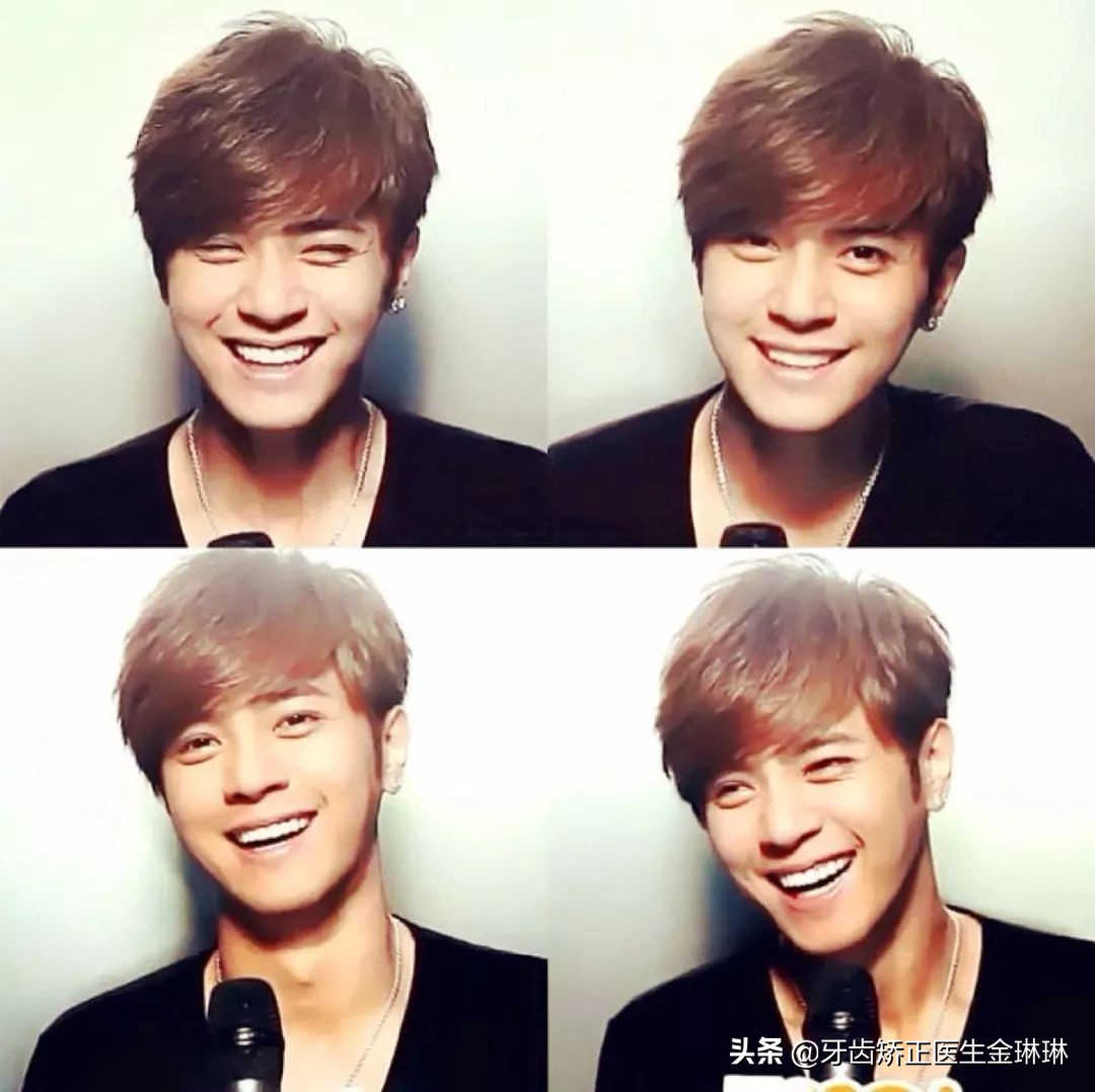 明星全口烤瓷牙的危害,明星为什么都做烤瓷牙