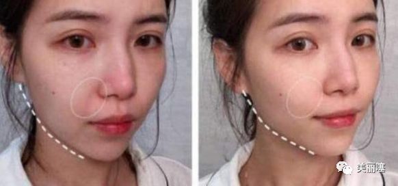 国内发现最尴尬的护肤品,国内尴尬级的护肤品