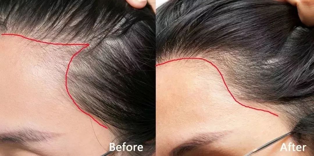 2021年平价去屑洗发水推荐测评,好的洗发水去屑顺滑蓬松控油止痒