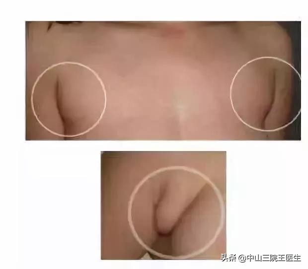 凉快宽松小背心遮副乳,夏季显瘦遮副乳背心