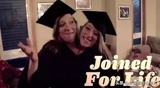 罕见双头连体人能活多久,诡异的双头生物