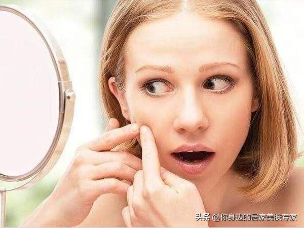 痘痘肌护理步骤,最全祛痘方法针对各种痘痘