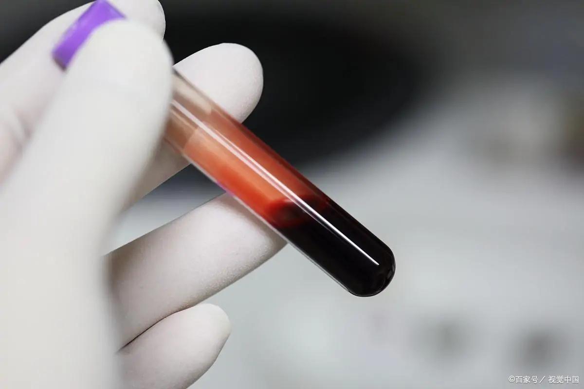 百草枯吃了有解药吗,百草枯没咽去能救活吗