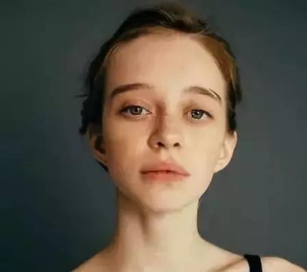 男生脸上的雀斑怎样快速去掉,小孩脸上有雀斑怎样才能去掉