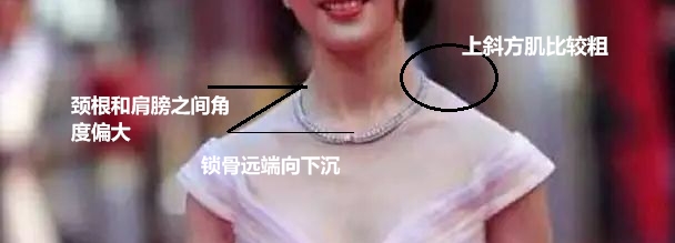 溜肩，长得再瘦体型也垮垮的。但溜肩常见这两种情况，别练错