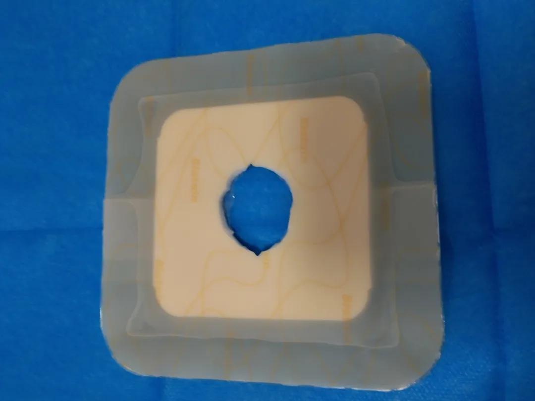 拜尔坦泡沫敷料能促进伤口愈合吗,什么样的病人应该用泡沫敷料