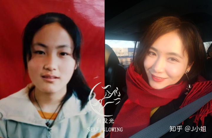 鱼尾纹和法令纹有什么区别,法令纹鱼尾纹都是岁月的痕迹