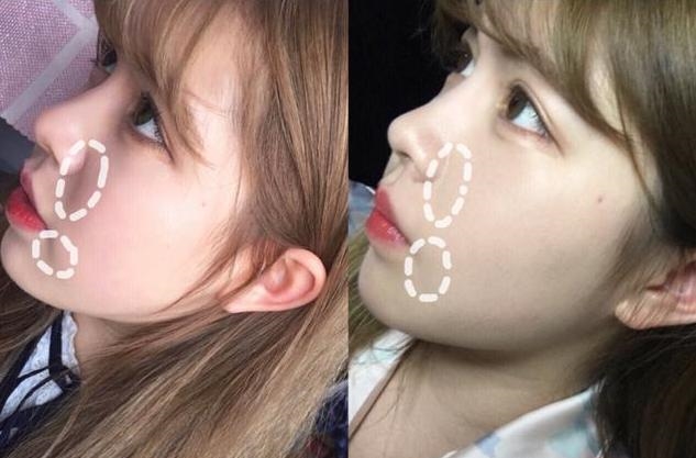 妻子种睫毛后变成面瘫，丈夫想离婚，妻子还沾沾自喜