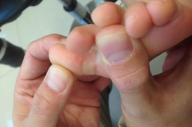 吃巧克力孩子会过敏吗,吃巧克力小孩会增加黑色素吗